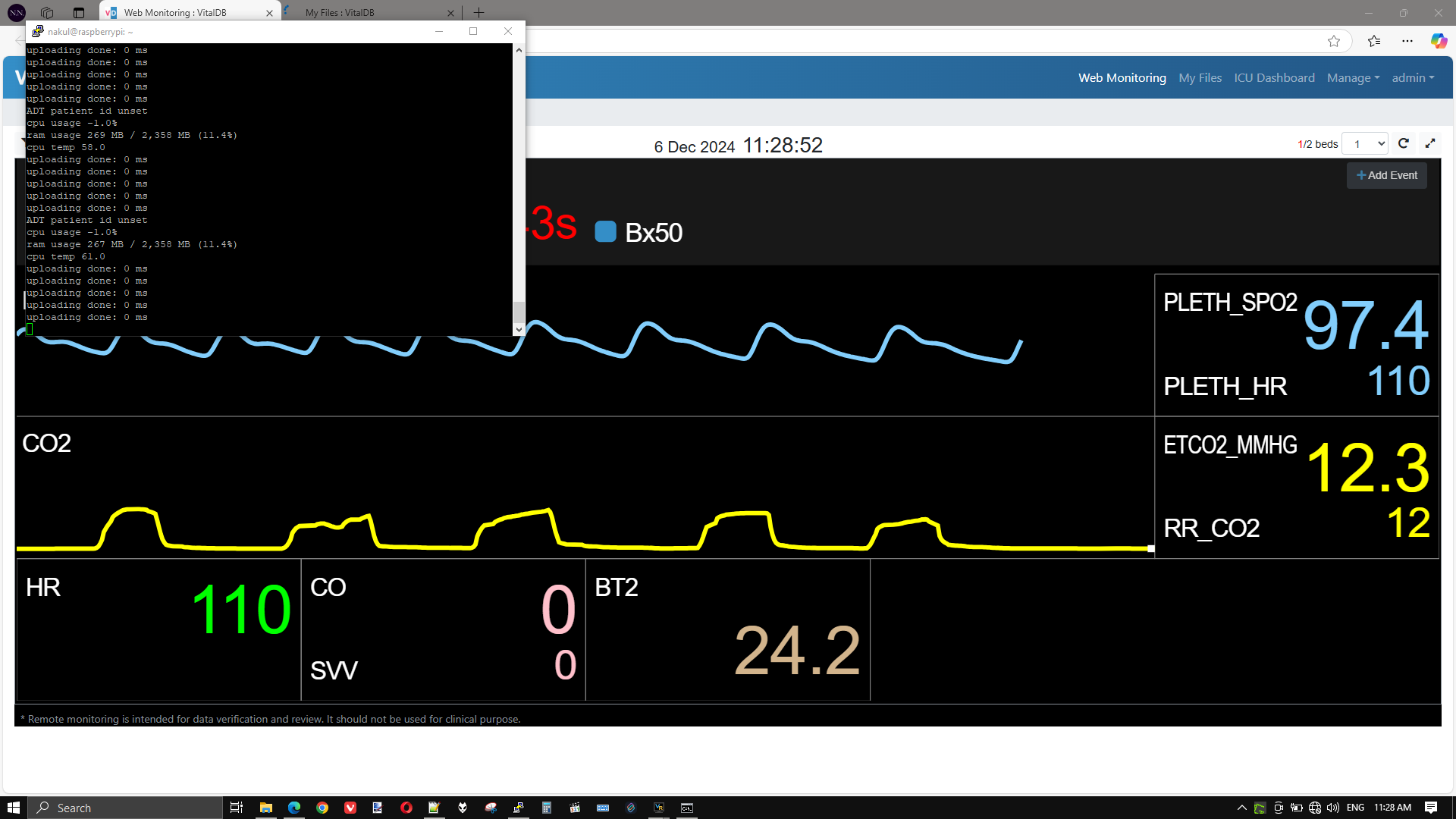 Same setup with B125M Patient Monitor (all available parameter being transmitting) 